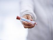 Sanidad notifica 6.280 nuevos casos de coronavirus y 15.322 altas en la Comunitat Valenciana Test covid 19