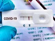 Sanidad no recomienda los tests rápidos de anticuerpos para el autodiagnóstico