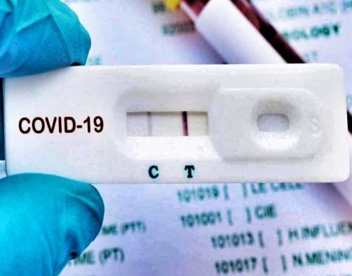 Sanidad no recomienda los tests rápidos de anticuerpos para el autodiagnóstico