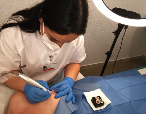 El Hospital de Elda pone en marcha una consulta de micropigmentación oncológica para pacientes sometidas a una reconstrucción mamaria El Hospital de Elda pone en marcha una consulta de micropigmentación oncológica para pacientes sometidas a una reconstrucción mamaria